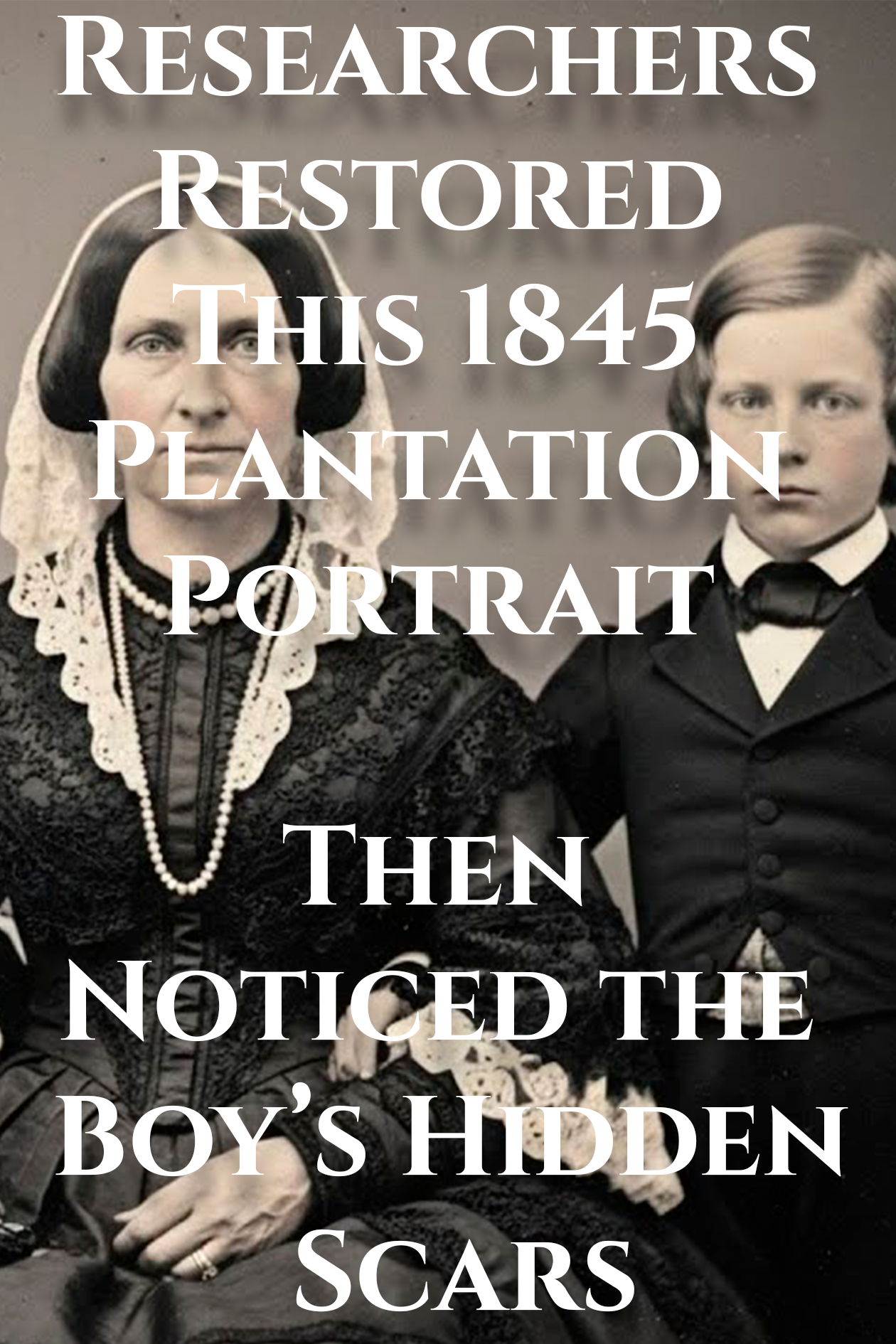 Researchers Restored This 1845 Plantation Portrait, Then Noticed the Boy’s Hidden Scars